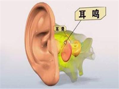耳鸣的中医辨证与治疗