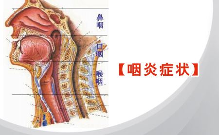 慢性咽炎的症状有哪些？