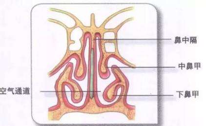 导致鼻中隔偏曲的原因