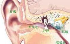鼓膜穿孔怎么治疗