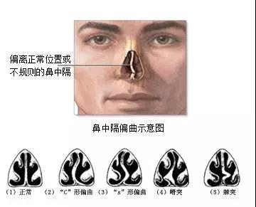 重庆耳鼻喉专科医院排名