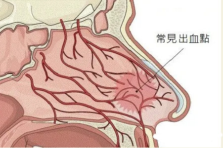 鼻部常见的出血点