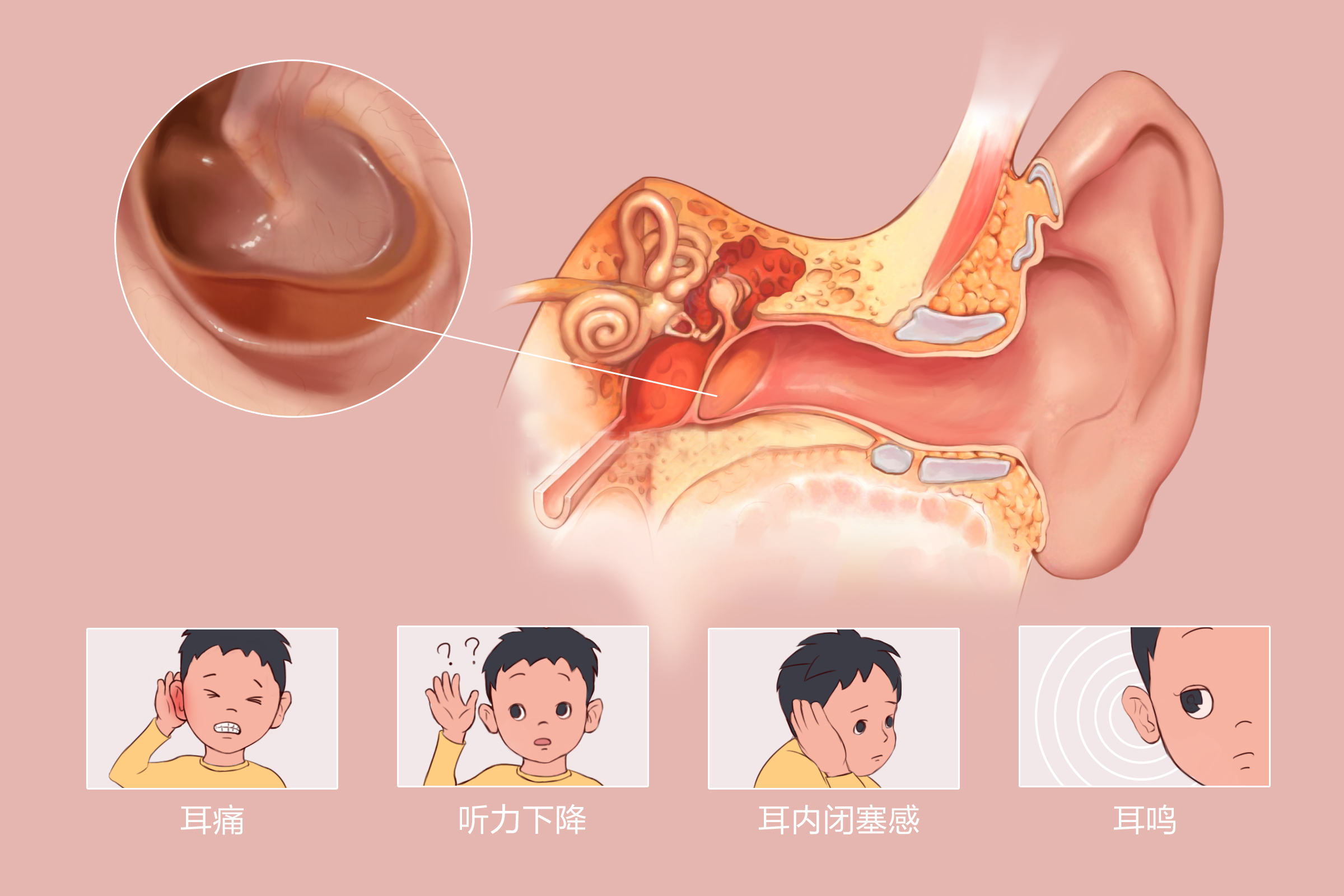 重庆治疗中耳炎医院