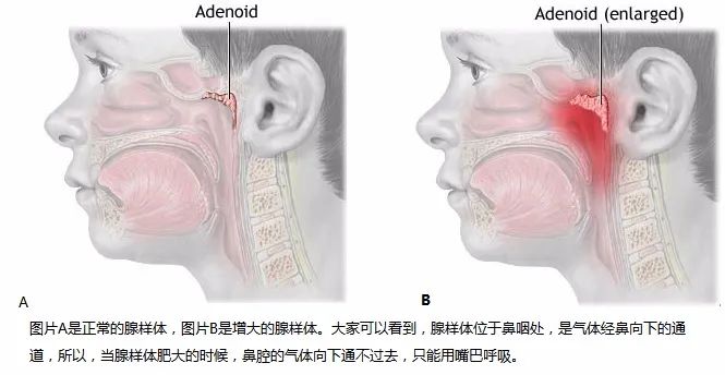 重庆耳鼻喉专科医院