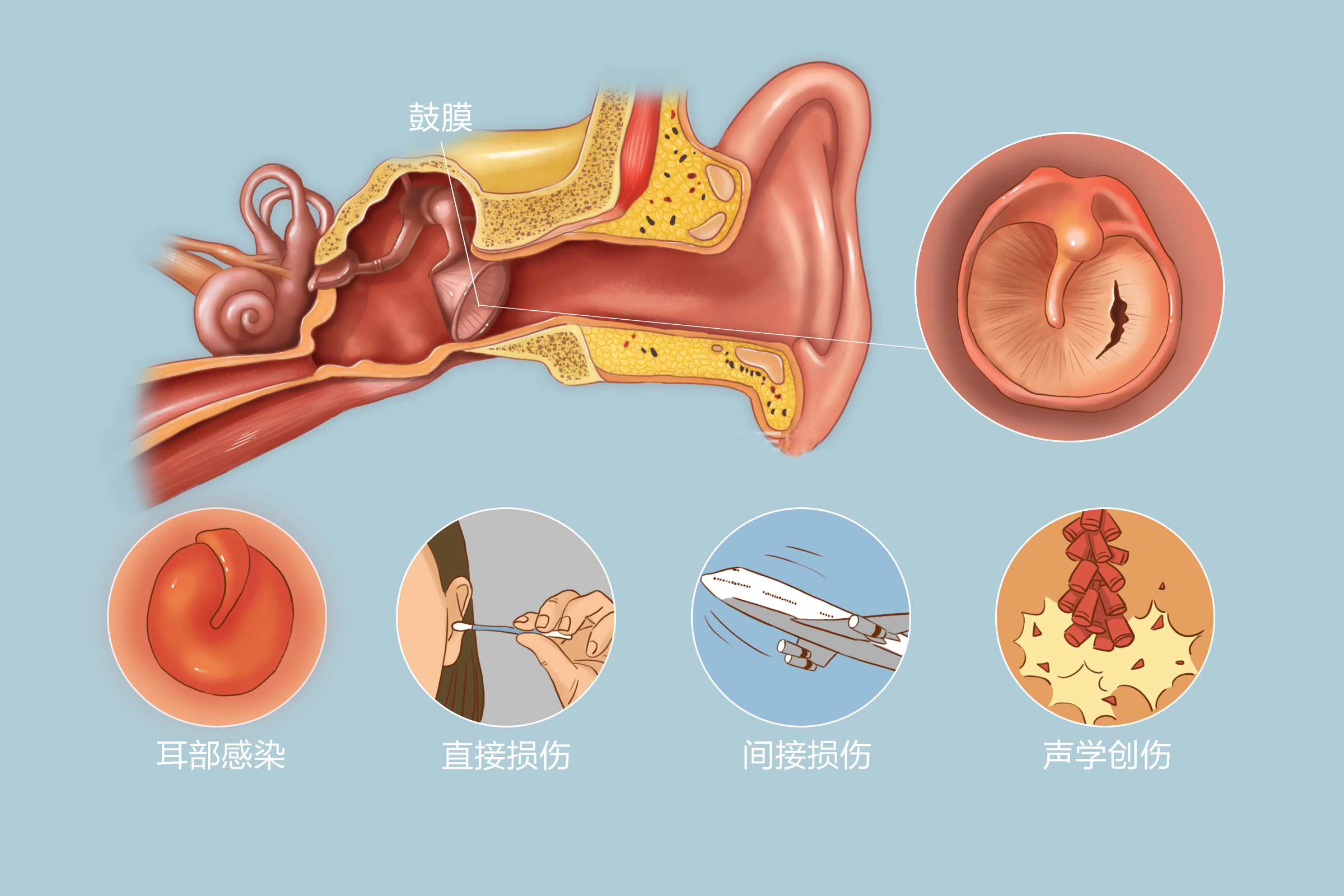 重庆治疗鼓膜穿孔医院排名